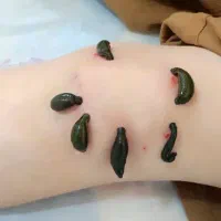 طب سوزنی،زالو درمانی،حجامت|خدمات آرایشگری و زیبایی|تربت جام, شهید نصرالهی|دیوار