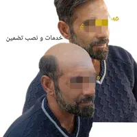 پروتزمو/ تخفیفات ویژه|خدمات آرایشگری و زیبایی|شیراز, صاحب الزمان|دیوار