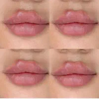 آموزش ژل ،بوتاکس، پی آر پی