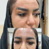 بوتاکس مصپورت۵۹۹ژل مجوزدار ۱/۲۰۰مادلینگ۵/۹۹۹|خدمات آرایشگری و زیبایی|قم, حاج زینل|دیوار