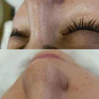 آموزش پاکسازی پوست فیشیال فیشال|خدمات آموزشی|کرمانشاه, |دیوار