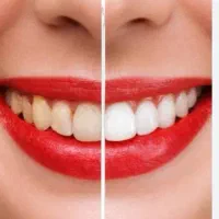 دندانپزشکی اقساطی
