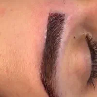 کاشت ابرو طبیعی ‌در کلینیک تخصصی کاشت اقساط