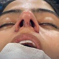 جراحی زیبایی صورت و بدن توسط پزشک فوق تخصص