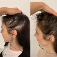بازگشت شادابیی موهاتو
