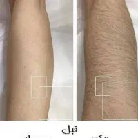 کندلا سنتر الماس