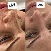 فیشیال