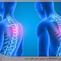 حرکات اصلاحی