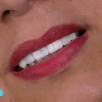 خدمات تخصصی دندانپزشکی در کلینیک نگین شیراز|خدمات آرایشگری و زیبایی|شیراز, زرگری|دیوار