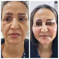 خدمات زیبایی پزشکی تزریق ژل و بوتاکس وچربی|خدمات آرایشگری و زیبایی|اهواز, کیانپارس |دیوار