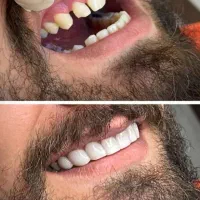 خدمات دندان پزشکی|خدمات آرایشگری و زیبایی|بروجرد, |دیوار