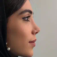 جراحی.بینی|خدمات آرایشگری و زیبایی|اراک, |دیوار