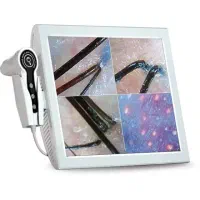 دستگاه آنالیز پوست و مو