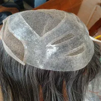 پروتز موی مردانه|آرایشی، بهداشتی، درمانی|تبریز, |دیوار