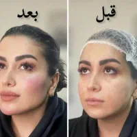 مادلینگ عربی ،شقیقه، مزو ،کانتورینگ.