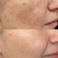 روغن تراپی با درآمد|خدمات آرایشگری و زیبایی|بانه, |دیوار