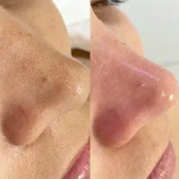 پاکسازی و فیشال تخصصی