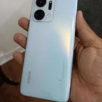 آنر،X7a.کارکرده،سالم.مهلت تست