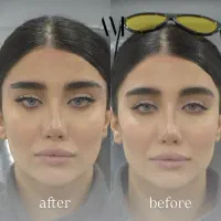 کلنیک زیبایی پوست و موی ارامش