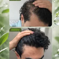 به موهات یه شانس دوباره بده