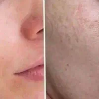 کرم شب تضمینی|آرایشی، بهداشتی، درمانی|خاش, |دیوار