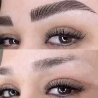 مرکز تخصصی پاک کردن تتو/میکرو،فیبروز ،شیدلب،آموزش|خدمات آرایشگری و زیبایی|گرگان, |دیوار