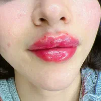 اجاره اتاق لیزر زیبایی فشیال