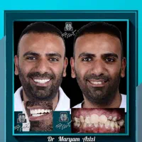 مرکز تخصصی دندانپزشکی عصب کشی دندان پزشکی|خدمات آرایشگری و زیبایی|شیراز, معالی‌آباد|دیوار