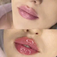 ارائه خدمات پزشک عمومی وزیبایی در نزل و محل کارشما|خدمات آرایشگری و زیبایی|خرم‌آباد, |دیوار