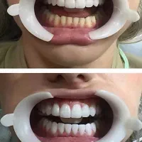 دندانپزشکی|خدمات آرایشگری و زیبایی|شیراز, شهرک گلدشت حافظ‎|دیوار