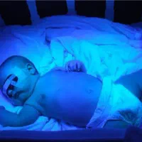 اجاره دستگاه درمان زردی نوزاد فتوتراپی