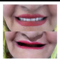 دندانسازی بابک طرح لبخند زیبا دندان|خدمات آرایشگری و زیبایی|اسفراین, |دیوار