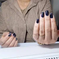 تخفیف ویژه کاشت ناخن