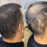 زیباییت رو بدست بیار