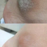 پدیکور و جوانسازی دست