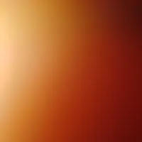 کیف گم کردم