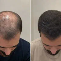 مگه من مرده باشم موهات بریزه