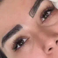 میکرو کاشت با 10میلیون تومان تخفیف