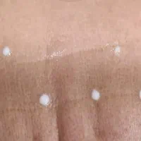 تزریق بوتاکس در مطب فقط برا این هفته