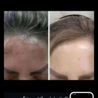 کرم ضدلک وروشن کننده|آرایشی، بهداشتی، درمانی|اهواز, فاز ۱ پادادشهر|دیوار