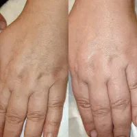 جشنواره یلدایی فشیال و پاکسازی پوست|خدمات آرایشگری و زیبایی|تهران, حکیمیه|دیوار