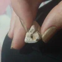 سنگ عتیقه|کلکسیون اشیاء عتیقه|دورود, |دیوار