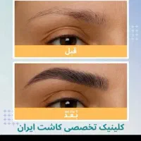 کاشت ابرو با قیمت استثنایی به مدت محدود|خدمات آرایشگری و زیبایی|تهران, دروس|دیوار