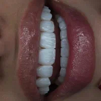 خدمات دندانپزشکی با شرایط اقساط