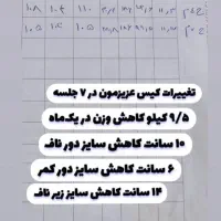 کلینیک لاغری با دستگاه با کاهش سایز ۱۵الی ۲۰|خدمات آرایشگری و زیبایی|شیراز, قدوسی غربی|دیوار