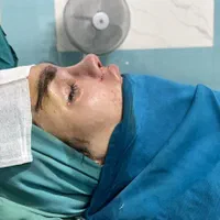 جراحی بینی 23پروتز سینه از 70، لیپو ابدو65|خدمات آرایشگری و زیبایی|تهران, صادقیه|دیوار