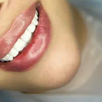 دندانپزشکی اقساطی با سفته