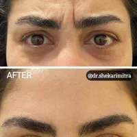 تزریقات زیبایی و خدمات درمانی|خدمات آرایشگری و زیبایی|کرج, دانشگاه آزاد|دیوار