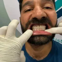 خدمات تخصصی ایمپلنت و اوردنچر|خدمات آرایشگری و زیبایی|اصفهان, کوی ولی عصر|دیوار