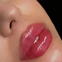 پاکسازی پوست ، ژل و بوتاکس در کلینیک زیبایی|خدمات آرایشگری و زیبایی|اهواز, پادادشهر|دیوار